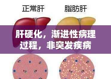 肝硬化,渐进性病理过程,非突发疾病