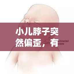 小儿脖子突然偏歪,有效治疗方法大盘点