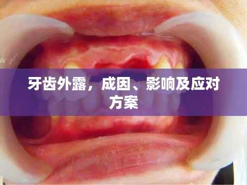 牙齿外露，成因、影响及应对方案